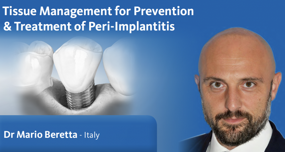 Tissue Management For Prevention & Treatment Of Peri-Implantitis