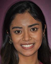 Dr Ruchira Chakraborty Forrest Avenue Dental Centre Bunbury