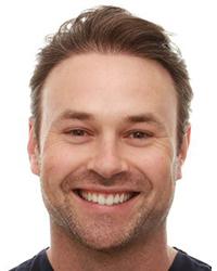 Dr Sven Nalder WA Dental Ellenbrook Ellenbrook