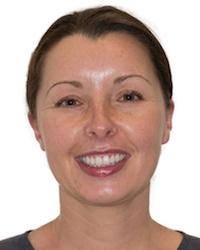 Ms Leianna Ornik South Yarra Dental Group South Yarra