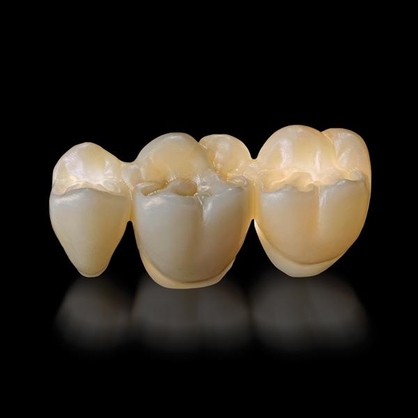 Strength meets aesthetics in multilayered zirconia from NobelProcera